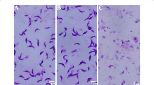 Toxoplasmosi nel gatto: sintomi, diagnosi e cura - Cos'è la toxoplasmosi nel gatto?